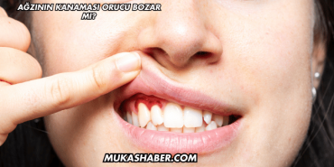 Ağzının Kanaması Orucu Bozar mı?