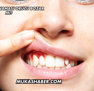 Ağzının Kanaması Orucu Bozar mı?