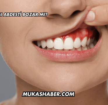 Diş Eti Kanaması Abdesti Bozar mı?