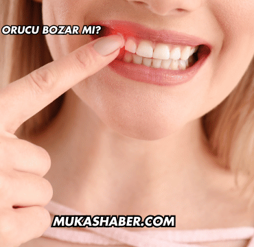 Diş Kanaması Orucu Bozar mı?