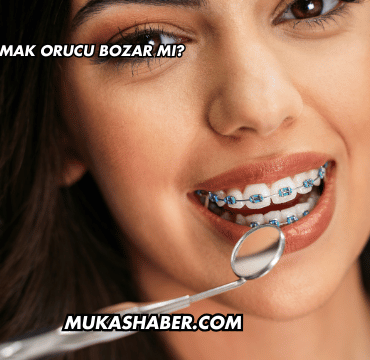 Diş Teli Taktırmak Orucu Bozar mı?