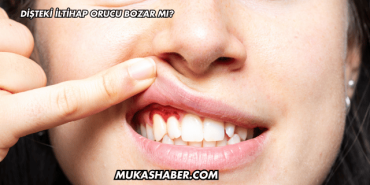 Dişteki İltihap Orucu Bozar mı?