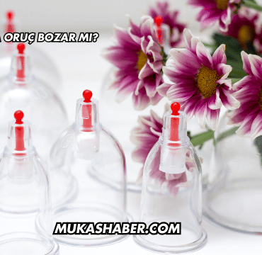 Kan Aldırma Oruç Bozar mı?