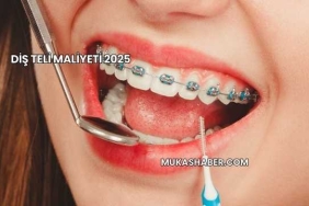 Diş Teli Maliyeti 2025