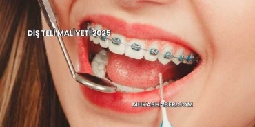 Diş Teli Maliyeti 2025