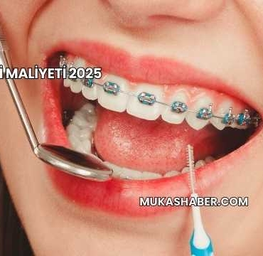 Diş Teli Maliyeti 2025
