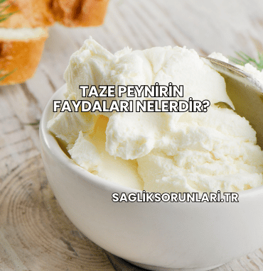 Taze Peynirin Faydaları Nelerdir?