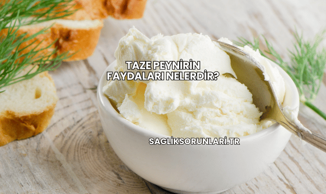 Taze Peynirin Faydaları Nelerdir?