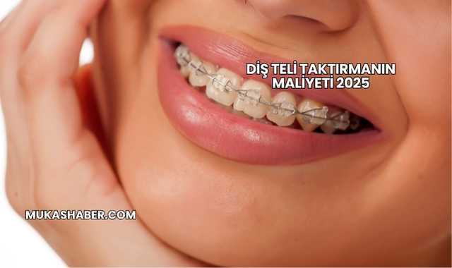 Diş Teli Taktırmanın Maliyeti 2025