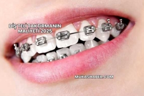 Diş Teli Taktırmanın Maliyeti 2025