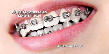 Diş Teli Taktırmanın Maliyeti 2025