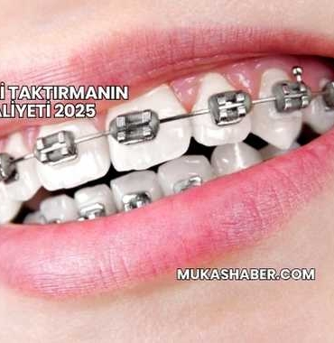 Diş Teli Taktırmanın Maliyeti 2025