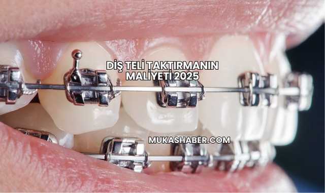 Diş Teli Taktırmanın Maliyeti 2025