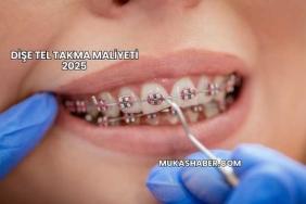 Dişe Tel Takma Maliyeti 2025