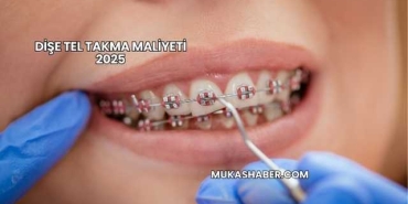 Dişe Tel Takma Maliyeti 2025