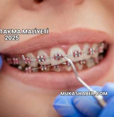 Dişe Tel Takma Maliyeti 2025