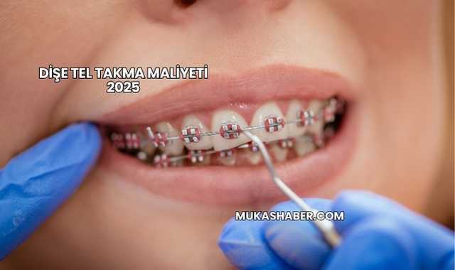 Dişe Tel Takma Maliyeti 2025