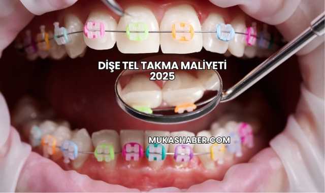 Dişe Tel Takma Maliyeti 2025