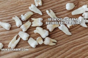 18'lik Diş Çıkarma Belirtileri Nelerdir?