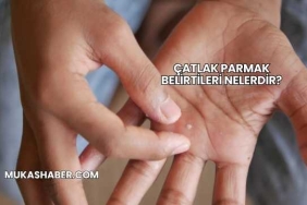 Çatlak Parmak Belirtileri Nelerdir?