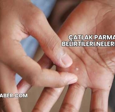 Çatlak Parmak Belirtileri Nelerdir?