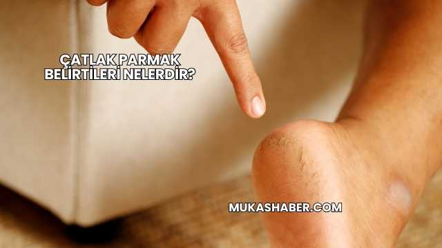 Çatlak Parmak Belirtileri Nelerdir?