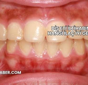 Diş Eti İltihabına Hangi İlaç İyi Gelir?