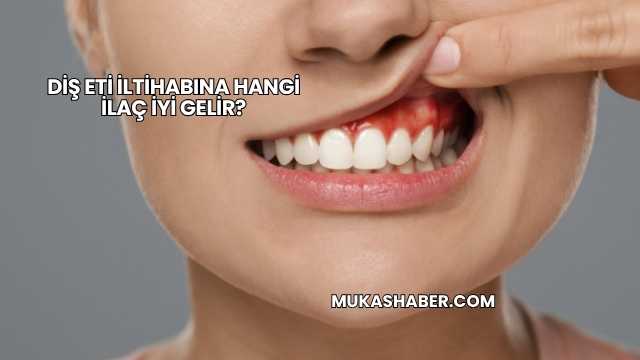 Diş Eti İltihabına Hangi İlaç İyi Gelir?