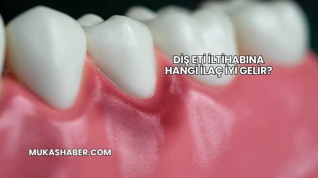 Diş Eti İltihabına Hangi İlaç İyi Gelir?