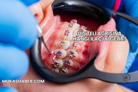 Diş Teli Ağrısına Hangi İlaç İyi Gelir?