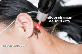 Dövme Sildirme Maliyeti 2025