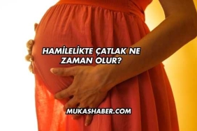 Hamilelikte Çatlak Ne Zaman Olur?