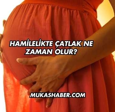 Hamilelikte Çatlak Ne Zaman Olur?