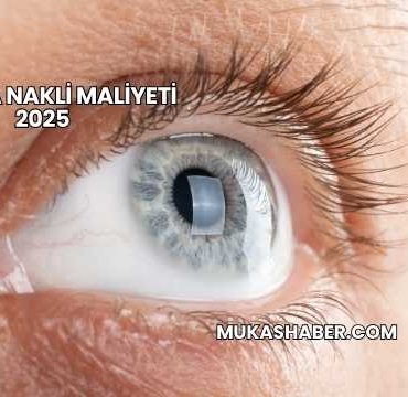 Kornea Nakli Maliyeti 2025