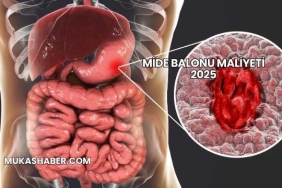 Mide Balonu Maliyeti 2025