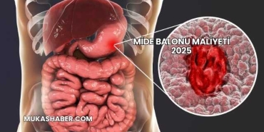 Mide Balonu Maliyeti 2025