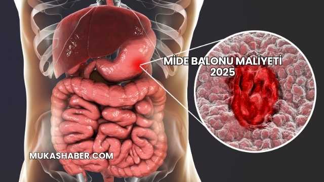 Mide Balonu Maliyeti 2025