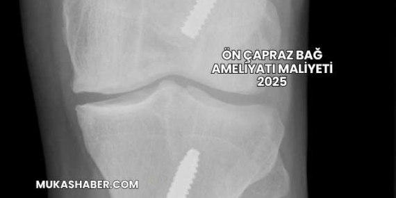 Ön Çapraz Bağ Ameliyatı Maliyeti 2025