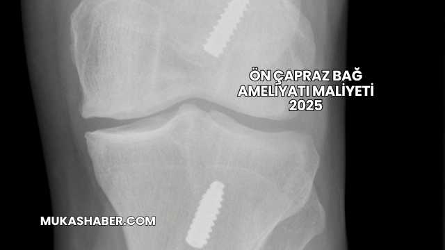 Ön Çapraz Bağ Ameliyatı Maliyeti 2025