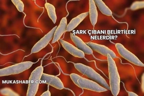 Şark Çıbanı Belirtileri Nelerdir?