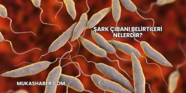 Şark Çıbanı Belirtileri Nelerdir?