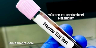 Yüksek TSH Belirtileri Nelerdir?