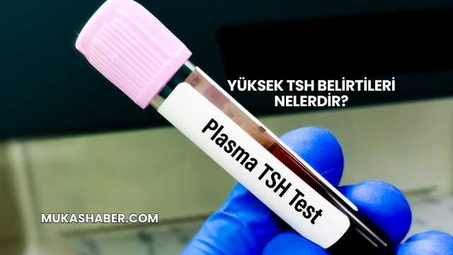 Yüksek TSH Belirtileri Nelerdir?