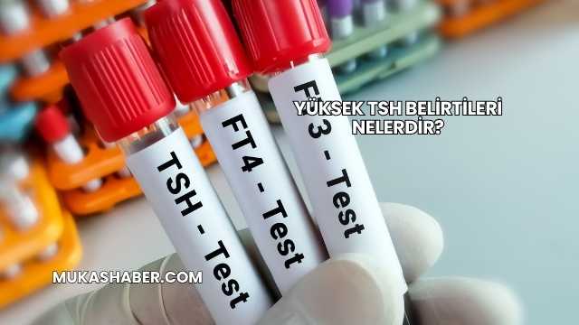 Yüksek TSH Belirtileri Nelerdir?