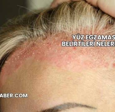 Yüz Egzaması Belirtileri Nelerdir?