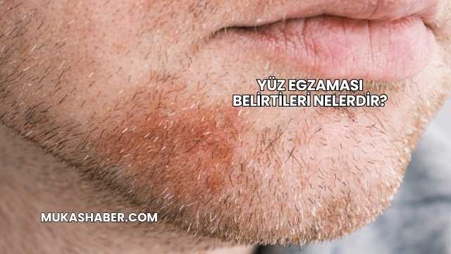 Yüz Egzaması Belirtileri Nelerdir?