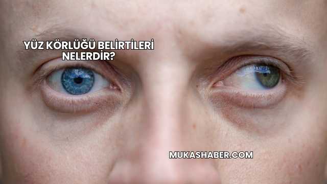 Yüz Körlüğü Belirtileri Nelerdir?