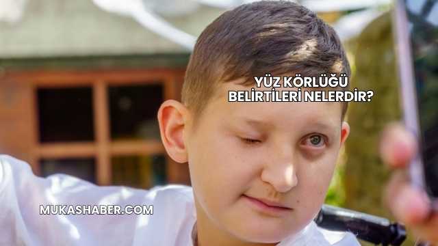 Yüz Körlüğü Belirtileri Nelerdir?