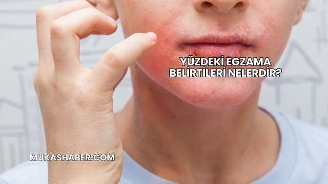 Yüzdeki Egzama Belirtileri Nelerdir?