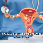 Vajinal Duş Nasıl Uygulanır?